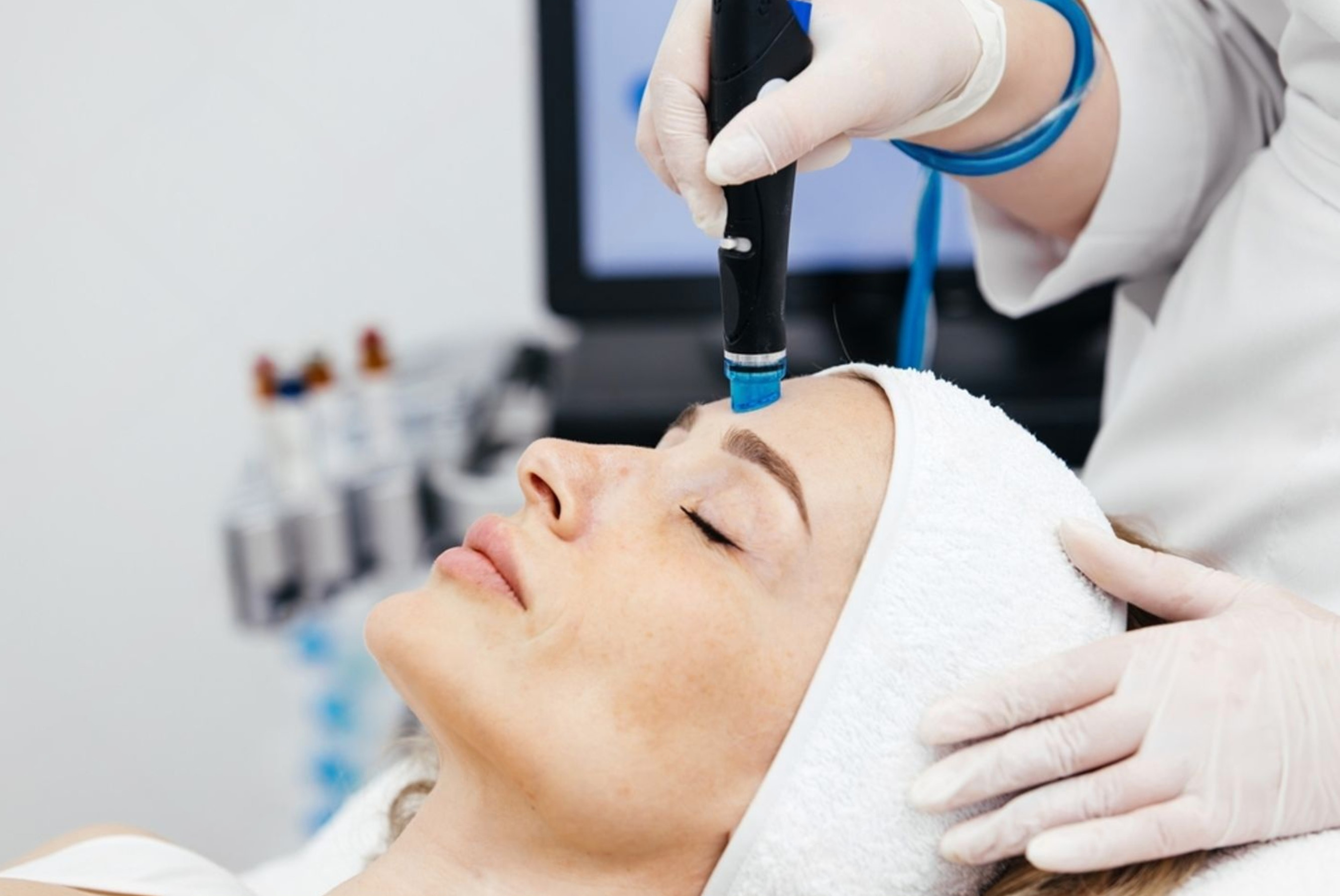 Médecine esthétique Paris 16 — microneedling, peeling, injections VivaSkin Esthétique